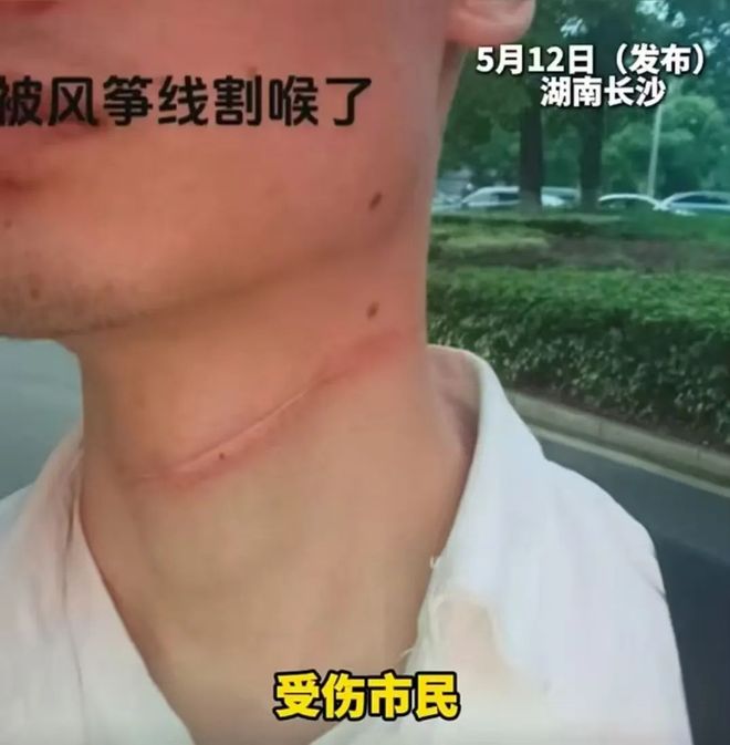 紧急提醒！长沙骑行男子遭割伤记者实测隐形